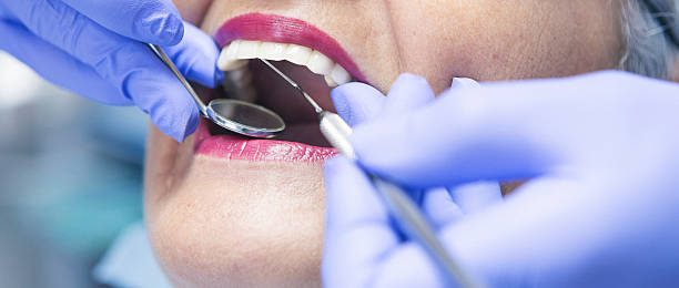 Best Knocked-Out Tooth Emergency  in Bear Creek, AL